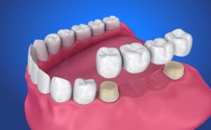 Los dientes: definición y características | ILERNA