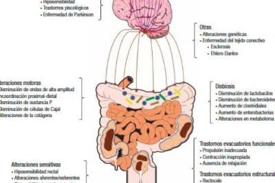 Constipación crónica. Conceptos actuales desde la fisiopatología ...