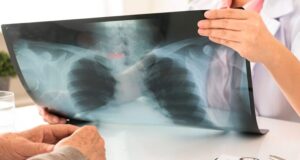 Qué es la radiología centrada en el paciente? - Blog de ...