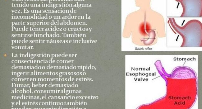 ▷ Conoce qué es la ingestión y su impacto en tu salud