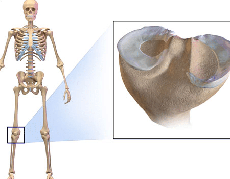 Meniscos: qué es, síntomas y tratamiento | Top Doctors